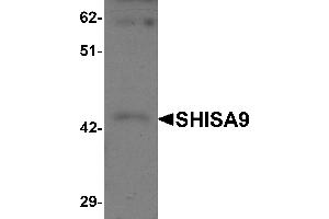 Western Blotting (WB) image for anti-Shisa Homolog 9 (Shisa9) (Middle Region) antibody (ABIN1031091) (Shisa9 抗体  (Middle Region))