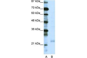 Human Jurkat; WB Suggested Anti-TAF10 Antibody Titration: 0. (TAF10 抗体  (C-Term))
