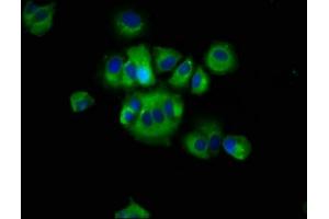 Immunofluorescence staining of MCF-7 cells with ABIN7168026 at 1:66, counter-stained with DAPI. (RHOD 抗体  (AA 1-80))