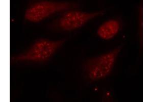 Immunofluorescence staining of methanol-fixed Hela cells, using Phospho-TP53-S315 antibody. (p53 抗体  (pSer315))