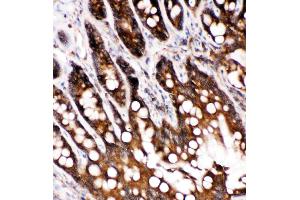 Anti-Caspase-6(P18) antibody, IHC(P): Rat Intestine Tissue