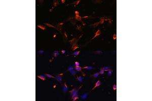 Immunofluorescence analysis of NIH/3T3 cells using CLDN5 antibody (ABIN6127705, ABIN6138692, ABIN6138693 and ABIN6214365) at dilution of 1:100. (Claudin 5 抗体  (AA 230-303))