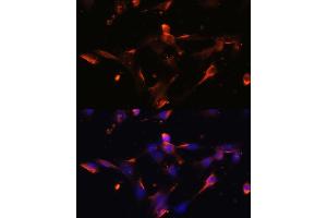Immunofluorescence analysis of NIH/3T3 cells using CLDN5 antibody (ABIN6127705, ABIN6138692, ABIN6138693 and ABIN6214365) at dilution of 1:100. (Claudin 5 抗体  (AA 230-303))