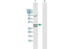 Western Blotting (WB) image for anti-Nudix (Nucleoside Diphosphate Linked Moiety X)-Type Motif 6 (NUDT6) (AA 1-316) antibody (ABIN524589)