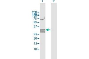 Western Blot analysis of NUDT6 expression in transfected 293T cell line by NUDT6 MaxPab polyclonal antibody. (NUDT6 抗体  (AA 1-316))