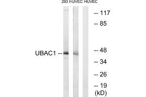 Western blot analysis of extracts from 293 cells and HUVEC cells, using UBAC1 antibody.