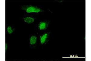 Immunofluorescence of monoclonal antibody to RDH12 on HeLa cell. (RDH12 抗体  (AA 217-316))