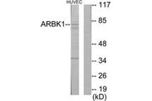 Western Blotting (WB) image for anti-Adrenergic, Beta, Receptor Kinase 1 (ADRBK1) (AA 601-650) antibody (ABIN2889434) (GRK2 抗体  (AA 601-650))
