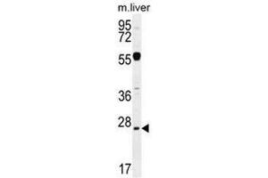 NPS3A Antibody (Center) western blot analysis in mouse liver tissue lysates (35µg/lane). (NIPSNAP3A 抗体  (Middle Region))