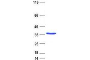 Validation with Western Blot (SLA Protein (His tag))
