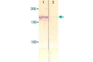 The cell lysate derived from insulin stimulated CHO was immunoprecipitated by IRS1 (phospho Y612) polyclonal antibody , then immunoprobed by the same antibody at 1 : 500 (Lane 1). (IRS1 抗体  (pTyr612))