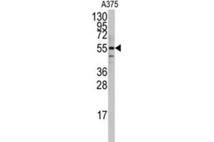 Western Blotting (WB) image for anti-Polymerase I and Transcript Release Factor (PTRF) antibody (ABIN3003202) (PTRF 抗体)