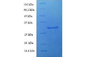 Parathyroid Hormone 2 Receptor (PTH2R) (AA 27-145), (Extracellular) protein (His-SUMO Tag)