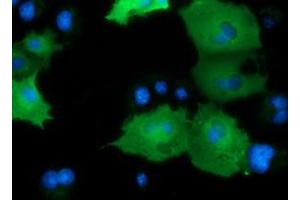 Image no. 14 for anti-DnaJ (Hsp40) Homolog, Subfamily A, Member 2 (DNAJA2) antibody (ABIN1497862)