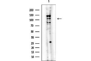 anti-Upregulator of Cell Proliferation (URGCP) antibody