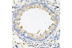 Immunohistochemistry (IHC) image for anti-Calumenin (CALU) (AA 20-315) antibody (ABIN6137878)