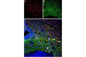 Multiplex staining of Parathyroid hormone receptor 1 and Orexin receptor 1 in rat ventromedial hypothalamus - Immunohistochemical staining of perfusion-fixed frozen rat brain sections using Anti-Orexin Receptor 1-ATTO Fluor-488 Antibody (ABIN7043286), (1:60) and Anti-PTH1R (extracellular) Antibody (ABIN7043429, ABIN7045112 and ABIN7045113), (1:60). (PTH1R 抗体  (Extracellular))
