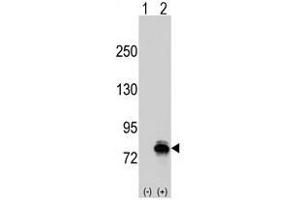 Image no. 1 for anti-K-Cadherin (CDH6) (N-Term) antibody (ABIN356889) (CDH6 抗体  (N-Term))