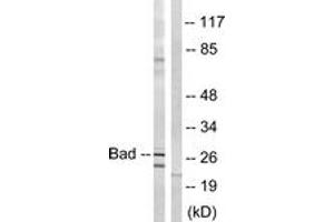 Western blot analysis of extracts from mouse liver cells, using BAD (Ab-134) Antibody. (BAD 抗体  (AA 100-149))
