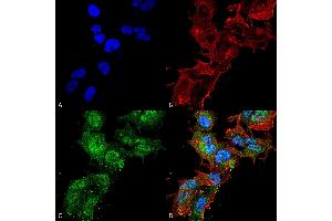 Immunocytochemistry/Immunofluorescence analysis using Rabbit Anti-Calcium Sensing Receptor Polyclonal Antibody . (CASR 抗体  (AA 1-100) (HRP))