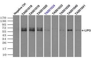 Image no. 1 for anti-Lipase, Endothelial (LIPG) antibody (ABIN1499166) (LIPG 抗体)