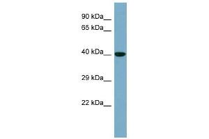 KCTD16 antibody used at 1 ug/ml to detect target protein. (KCTD16 抗体  (N-Term))