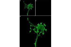 Unlabeled α-Bungarotoxin successfully blocks nicotinic ACh channels access. (alpha-Bungarotoxin protein (Atto 647N))