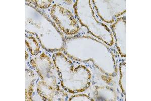 Immunohistochemistry of paraffin-embedded human kidney using PTPRA Antibody (ABIN3015783, ABIN3015784, ABIN1682399 and ABIN6219134) at dilution of 1:100 (40x lens). (PTPRA 抗体  (AA 20-142))