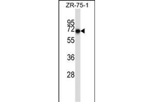 CD5 Antibody (Center) (ABIN657456 and ABIN2846483) western blot analysis in ZR-75-1 cell line lysates (35 μg/lane). (CD5 抗体  (AA 203-232))