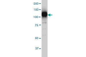 SIRT1 monoclonal antibody (M01), clone 7B7 Western Blot analysis of SIRT1 expression in Hela S3 NE . (SIRT1 抗体  (AA 456-555))