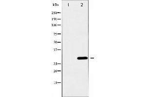 Western blot analysis of BCL-XL expression in UV treated 293 whole cell lysates,The lane on the left is treated with the antigen-specific peptide. (BCL2L1 抗体  (N-Term))