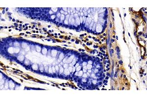 Immunohistochemistry (IHC) image for anti-Fibrinogen gamma Chain (FGG) (AA 166-416) antibody (ABIN7434950)