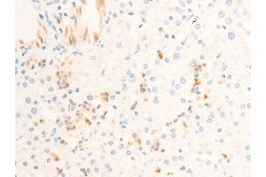 ABIN6267302 at 1/100 staining human liver tissue sections by IHC-P. (ICAM1 抗体  (pTyr512))