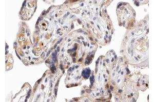 ABIN6267653 at 1/100 staining human Placenta tissue sections by IHC-P. (PKD1/2/3/PKC mu (pSer738), (pSer742) 抗体)
