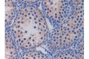 DAB staining on IHC-P; Samples: Mouse Testis Tissue (Fatty Acid Synthase 抗体  (AA 2257-2504))