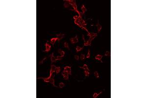 ABIN6267335 staining 293 by IF/ICC. (IGF1R 抗体  (pTyr1165, pTyr1166))