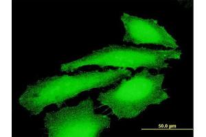 Immunofluorescence of purified MaxPab antibody to MAGEE1 on HeLa cell. (MAGEE1 抗体  (AA 1-957))