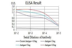 Black line: Control Antigen (100 ng),Purple line: Antigen (10 ng), Blue line: Antigen (50 ng), Red line:Antigen (100 ng) (GRM8 抗体  (AA 440-583))