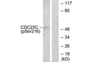 Western blot analysis of extracts from HuvEc cells treated with serum 20% 30', using CDC25C (Phospho-Ser216) Antibody.