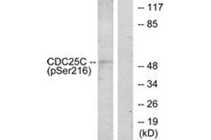 Western blot analysis of extracts from HuvEc cells treated with serum 20% 30', using CDC25C (Phospho-Ser216) Antibody. (CDC25C 抗体  (pSer216))