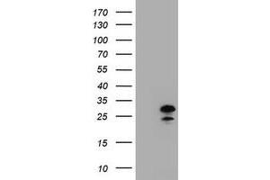 Image no. 2 for anti-Zinc Finger, AN1-Type Domain 5 (ZFAND5) antibody (ABIN1501812) (ZFAND5 抗体)