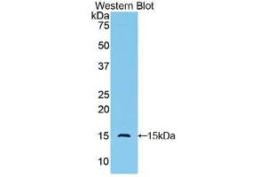 Western blot analysis of the recombinant protein. (GLG1 抗体  (AA 1048-1145))