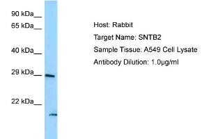 Host: Rabbit Target Name: SNTB2 Sample Type: A549 Whole Cell lysates Antibody Dilution: 1.