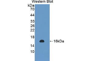 Western blot analysis of the recombinant protein. (NSP5 抗体  (AA 961-1063))