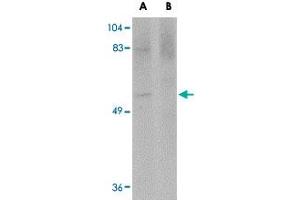 Western blot analysis of MATN4 in rat brain tissue lysate with MATN4 polyclonal antibody  at 1 ug/mL in (A) the absence and (B) the presence of blocking peptide. (MATN4 抗体  (N-Term))