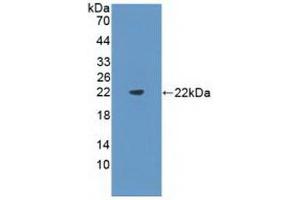 Detection of Recombinant Flt3L, Mouse using Polyclonal Antibody to FMS Like Tyrosine Kinase 3 Ligand (Flt3L) (FLT3LG 抗体  (AA 27-189))