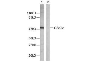 Western blot analysis of extracts from ovary cancer cells using GSK3α (Ab-21) antibody (E021007) (GSK3 alpha 抗体)