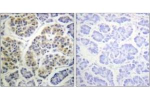 Immunohistochemistry analysis of paraffin-embedded human pancreas, using 14-3-3 thet/tau (Phospho-Ser232) Antibody. (14-3-3 theta 抗体  (pSer232))