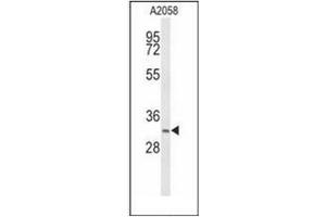 Western blot analysis of 17-beta-HSD12 / HSD17B12 Antibody (Center) in A2058 cell line lysates (35ug/lane).