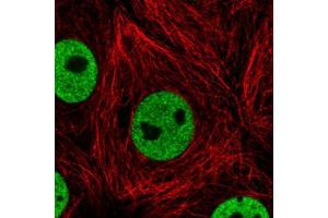 Immunofluorescent staining of MCF7 cells with HNRNPC monoclonal antibody, clone CL2593  (Green) shows distinct nuclear (without nucleoli).